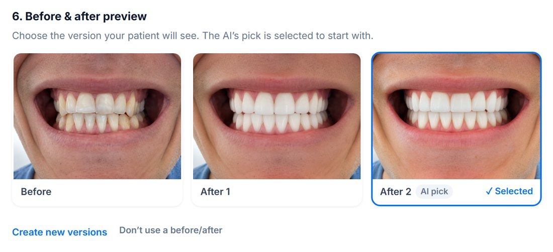 Choosing the patient's before and after smile simulation: their photo and two AI-generated versions, the AI's pick selected