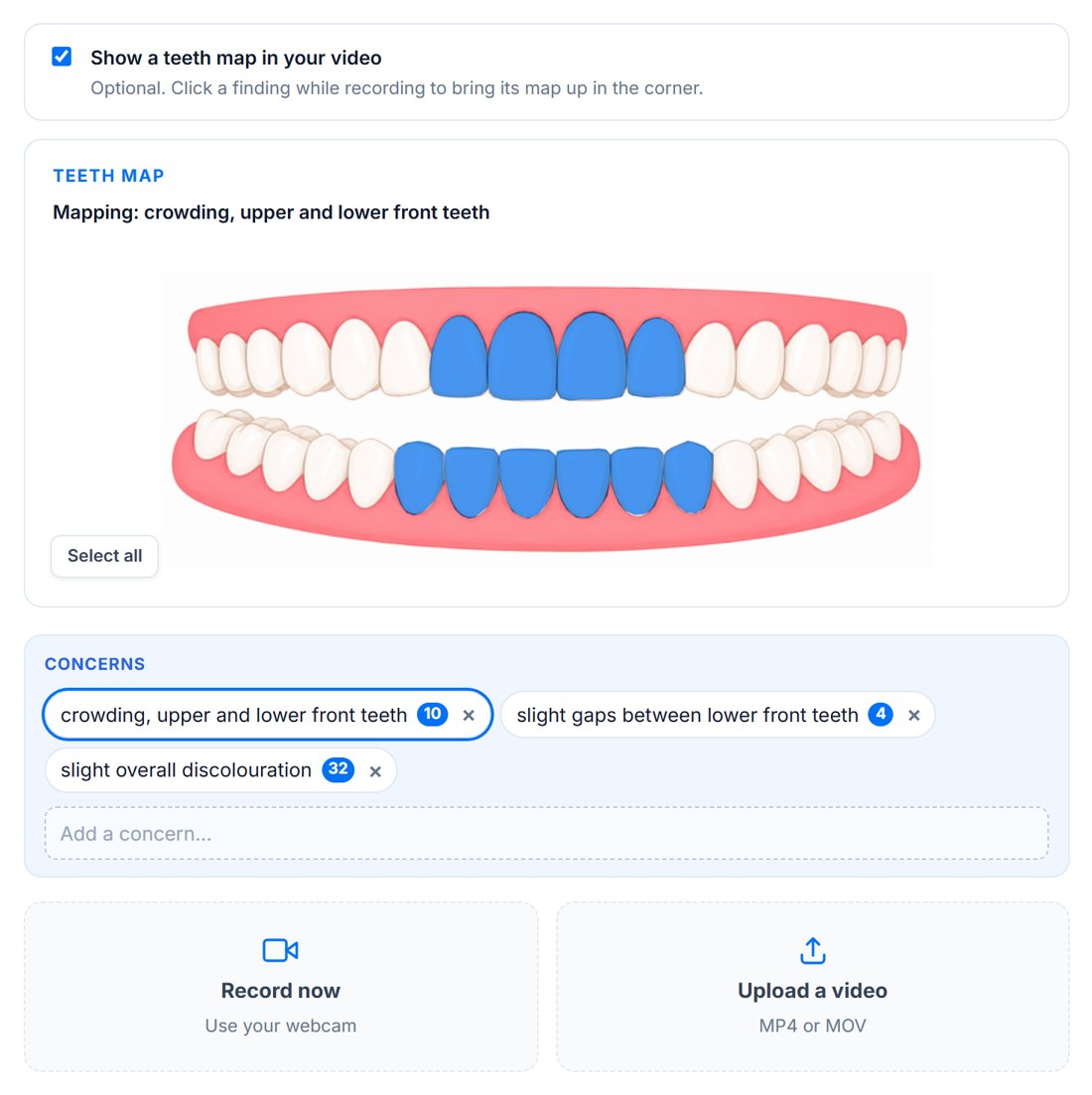 Personal video set-up: show a teeth map in your video, the mapped concerns, and record now or upload a video
