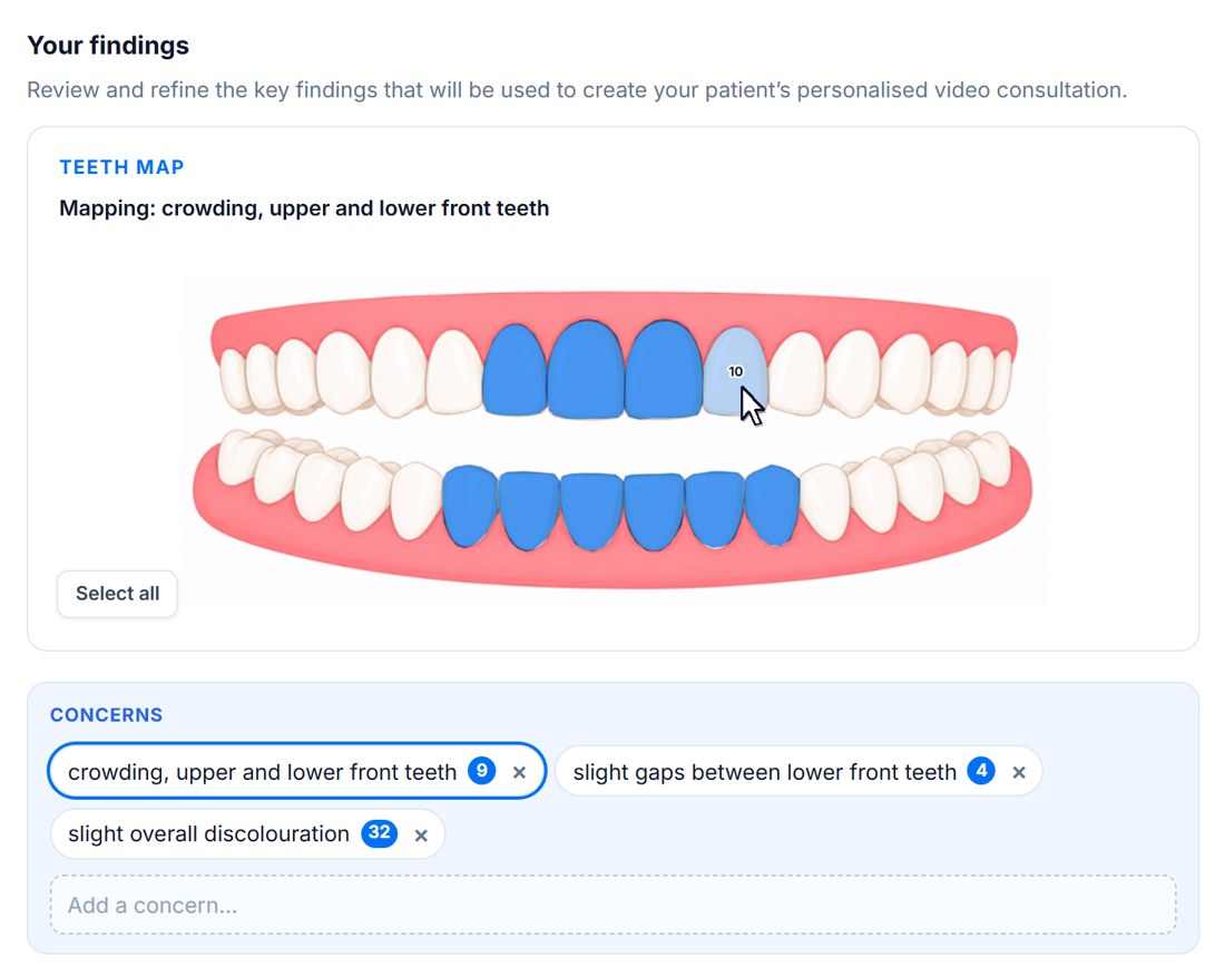 Teeth map with the upper and lower front teeth highlighted for a crowding concern, above the patient's concerns